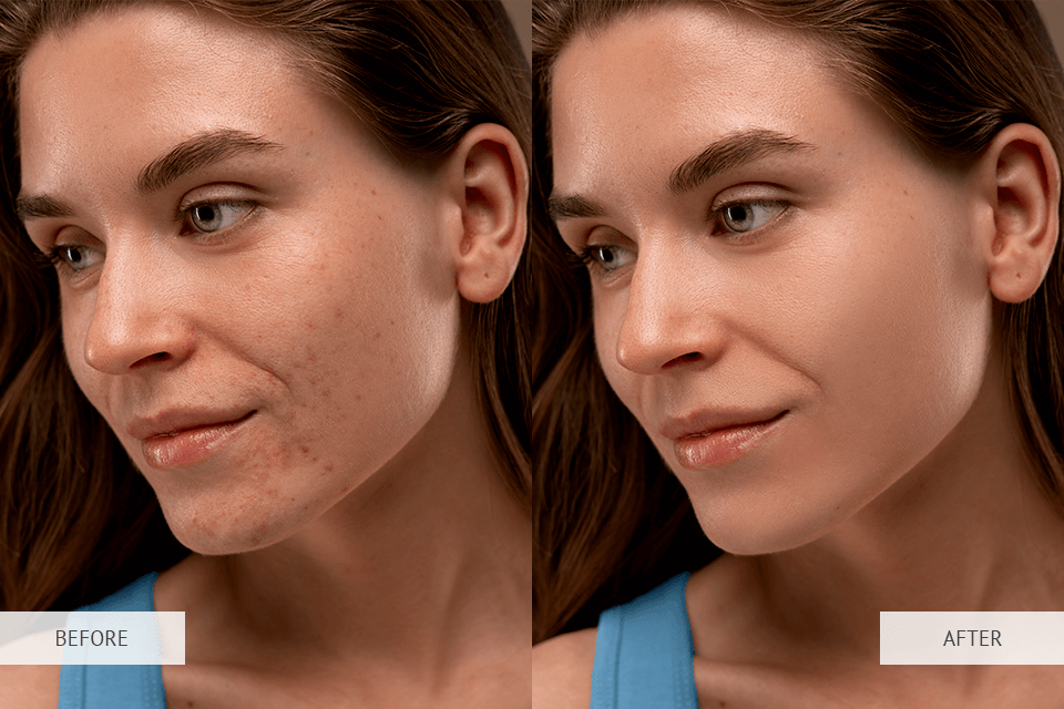 scar removal app before after comparison