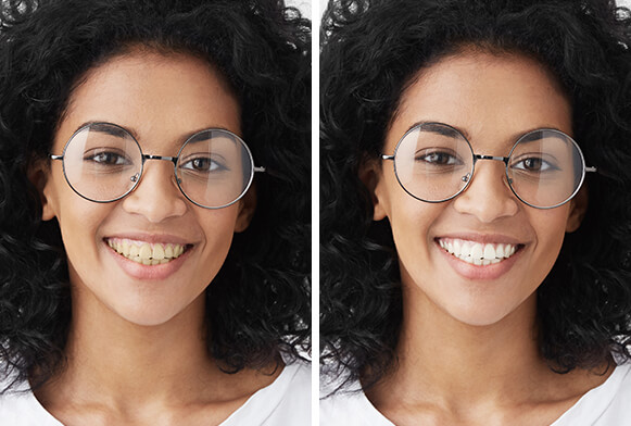 blanchiment des dents dans Lightroom