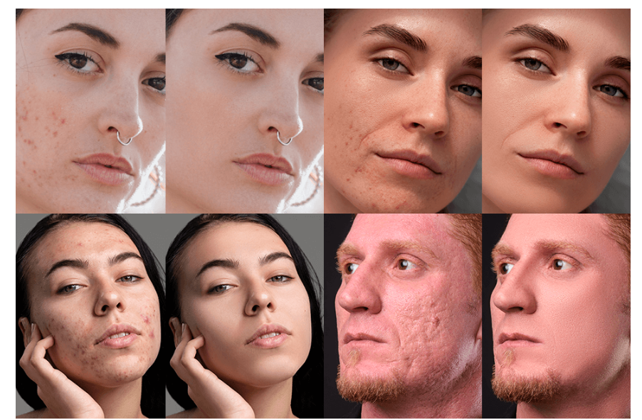 types scar removal app