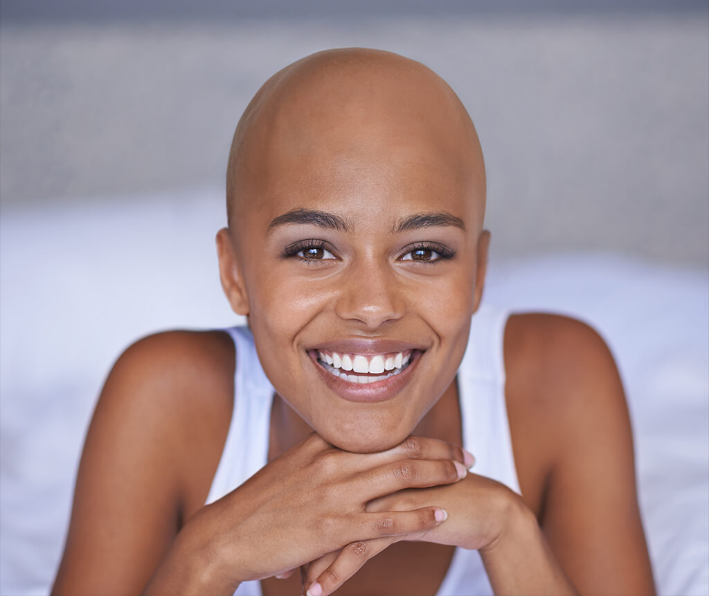 would i look good bald