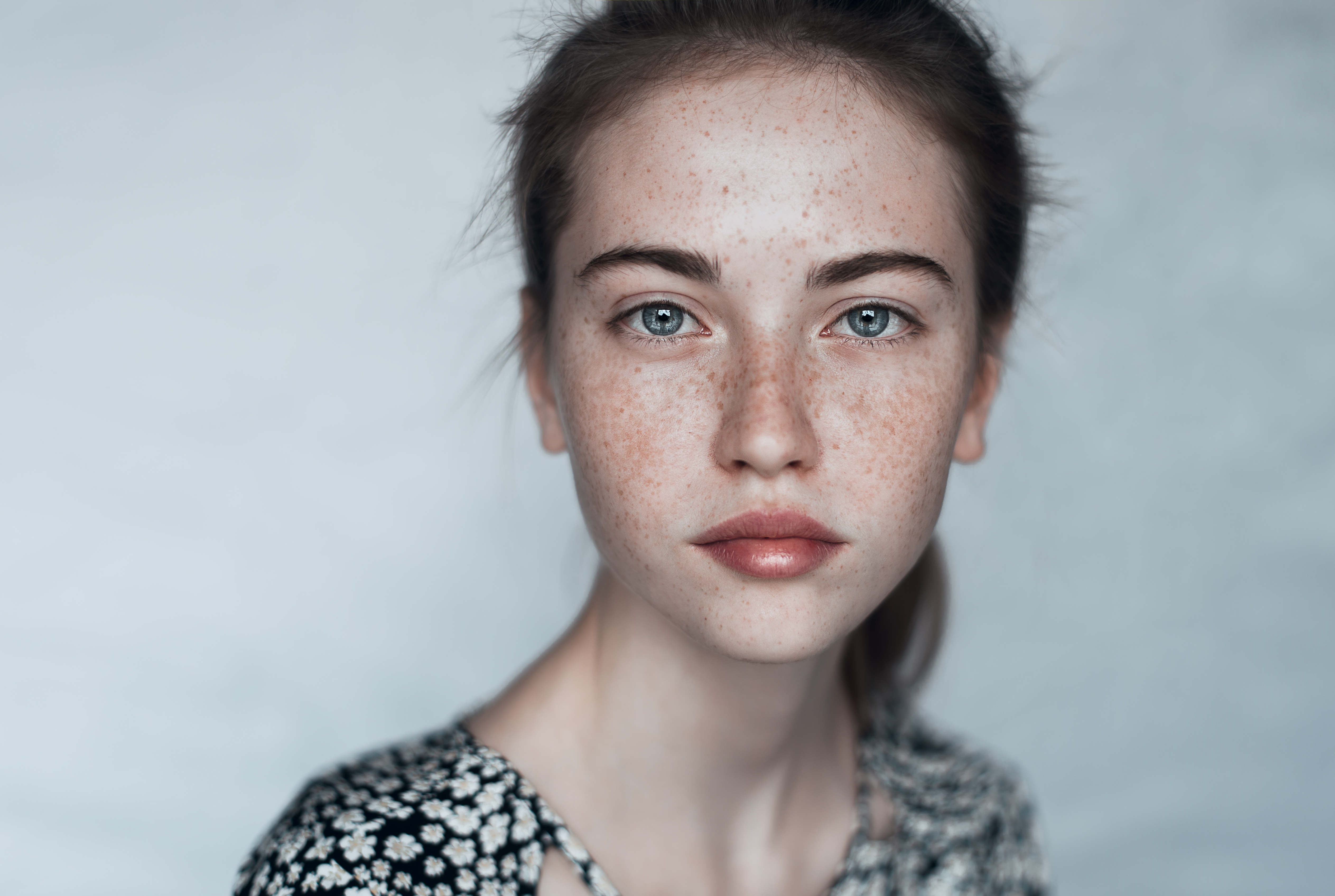 Портрет девушки с проблемной кожей